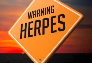 herpes na usni